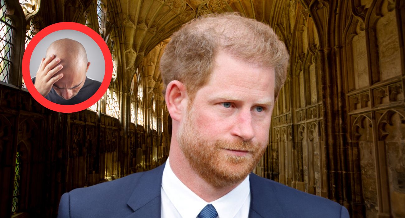 Principe Harry: le accuse sul parrucchino infamanti