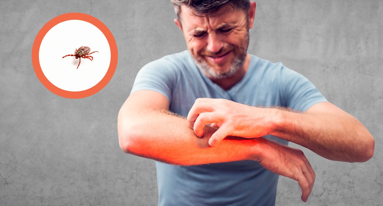 Tutto quello che non sai sul morso di zecca