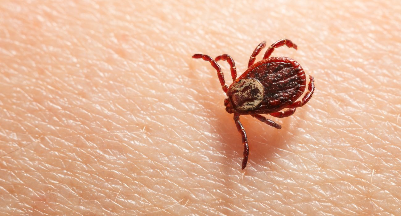 Zecca morde il piede di un uomo: medici costretti ad amputare le dita