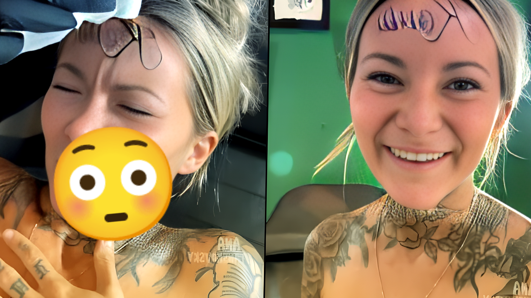 La ragazza che si tatua il nome del fidanzato in fronte: Ma cosa accade dopo?